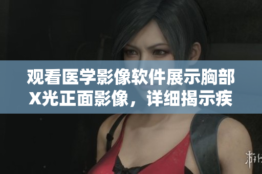 觀看醫(yī)學影像軟件展示胸部X光正面影像，詳細揭示疾病跡象